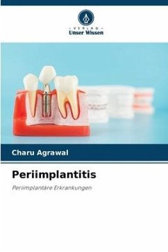 Cover Periimplantitis