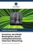 Invasive zervikale Resorption durch iontophoretisches internes Bleaching