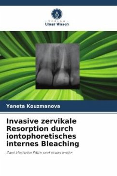 Invasive zervikale Resorption durch iontophoretisches internes Bleaching - Kouzmanova, Yaneta