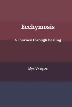 Ecchymosis - Vasquez, Mya