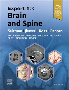 ExpertDDx: Brain and Spine - Salzman, Karen L.; Jhaveri, Miral D.; Ross, Jeffrey S.