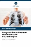Lungentuberkulose und thrombotische Erkrankungen
