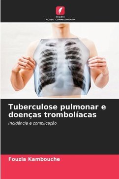 Tuberculose pulmonar e doenças trombolíacas - Kambouche, Fouzia