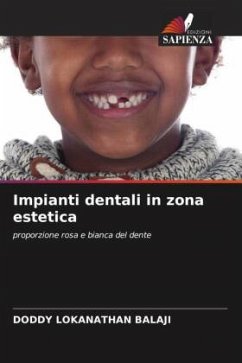 Impianti dentali in zona estetica - Balaji, Doddy Lokanathan