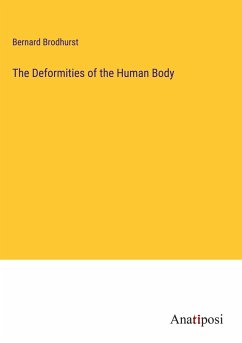 The Deformities of the Human Body - Brodhurst, Bernard