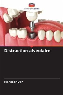 Distraction alvéolaire - Dar, Manzoor