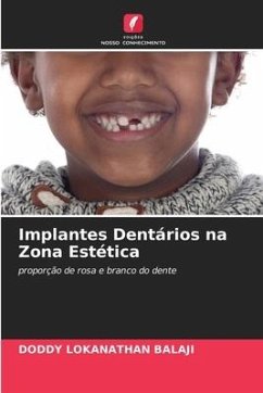 Implantes Dentários na Zona Estética - Balaji, Doddy Lokanathan