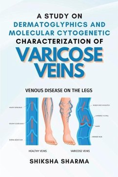 A Study on Dermatoglyphics and Molecular Cytogenetic Characterization of Varicose Veins - Sharma, Shiksha