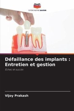 Défaillance des implants : Entretien et gestion - Prakash, Vijoy