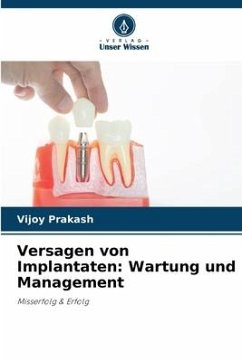 Versagen von Implantaten: Wartung und Management - Prakash, Vijoy