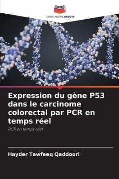 Expression du gène P53 dans le carcinome colorectal par PCR en temps réel - Qaddoori, Hayder Tawfeeq