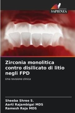 Zirconia monolitica contro disilicato di litio negli FPD - S., Sheeba Shree;MDS, Aarti Rajambigai;MDS, Ramesh Raja