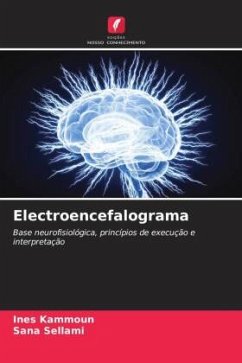 Electroencefalograma - Kammoun, Ines;Sellami, Sana