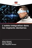 L'ostéo-intégration dans les implants dentaires