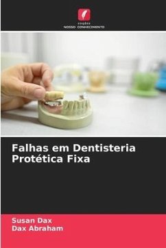 Falhas em Dentisteria Protética Fixa - Dax, Susan;Abraham, Dax