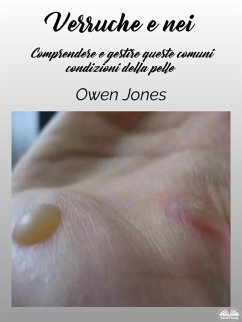 Verruche E Nei (eBook, ePUB) - Jones, Owen