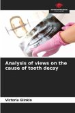 Analysis of views on the cause of tooth decay