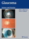 Glaucoma (eBook, ePUB)