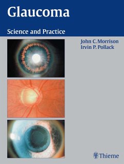 Glaucoma (eBook, ePUB) - Morrison, John C.; Pollack, Irvin P.
