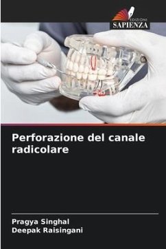 Perforazione del canale radicolare - SINGHAL, PRAGYA;Raisingani, Deepak