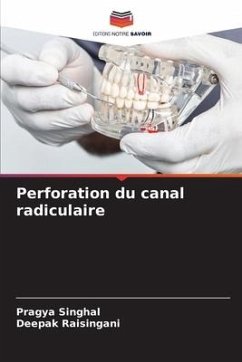 Perforation du canal radiculaire - SINGHAL, PRAGYA;Raisingani, Deepak