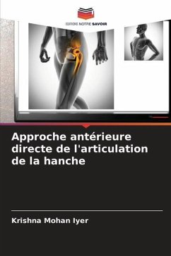 Approche antérieure directe de l'articulation de la hanche - Iyer, Krishna Mohan