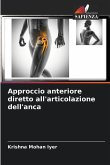 Approccio anteriore diretto all'articolazione dell'anca