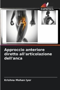 Approccio anteriore diretto all'articolazione dell'anca - Iyer, Krishna Mohan