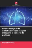 Broncoscopia de autofluorescência por imagem e cancro do pulmão