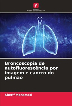 Broncoscopia de autofluorescência por imagem e cancro do pulmão - Mohamed, Sherif