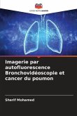 Imagerie par autofluorescence Bronchovidéoscopie et cancer du poumon