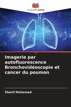 Imagerie par autofluorescence Bronchovidéoscopie et cancer du poumon - Mohamed, Sherif