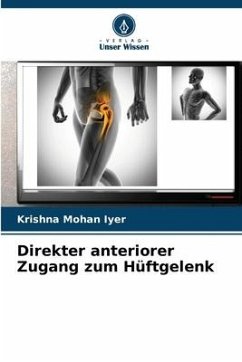 Direkter anteriorer Zugang zum Hüftgelenk - Iyer, Krishna Mohan