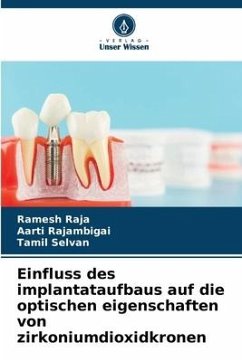 Einfluss des implantataufbaus auf die optischen eigenschaften von zirkoniumdioxidkronen - RAJA, Ramesh;RAJAMBIGAI, AARTI;Selvan, Tamil