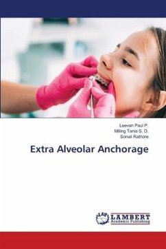 Extra Alveolar Anchorage