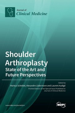 Cover Shoulder Arthroplasty