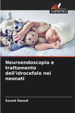Neuroendoscopia e trattamento dell'idrocefalo nei neonati - Daoud, Souad