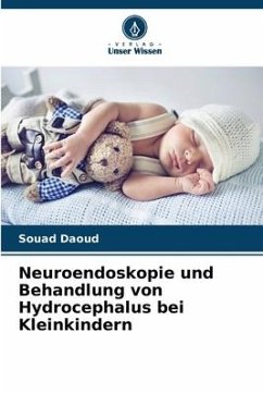 Neuroendoskopie und Behandlung von Hydrocephalus bei Kleinkindern - Daoud, Souad