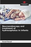 Neuroendoscopy and treatment of hydrocephalus in infants