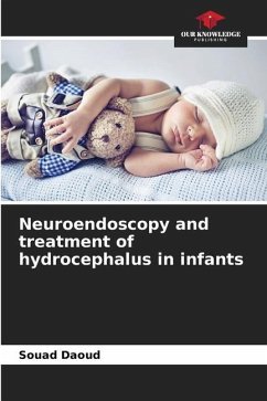 Neuroendoscopy and treatment of hydrocephalus in infants - Daoud, Souad