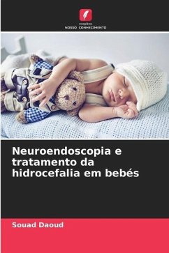 Neuroendoscopia e tratamento da hidrocefalia em bebés - Daoud, Souad