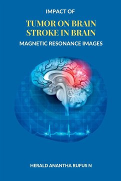 Impact of Tumor on Brain Stroke in Brain Magnetic Resonance Images - N, Herald Anantha Rufus