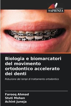 Biologia e biomarcatori del movimento ortodontico accelerato dei denti - Ahmad, Farooq;Mohan, Stuti;JUNEJA, ACHINT