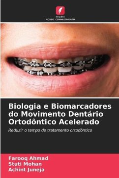 Biologia e Biomarcadores do Movimento Dentário Ortodôntico Acelerado - Ahmad, Farooq;Mohan, Stuti;JUNEJA, ACHINT