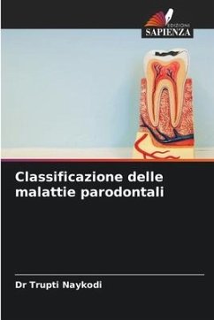 Classificazione delle malattie parodontali - Naykodi, Dr Trupti