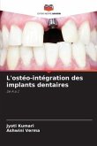 L'ostéo-intégration des implants dentaires