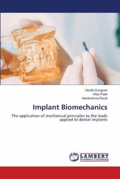 Implant Biomechanics