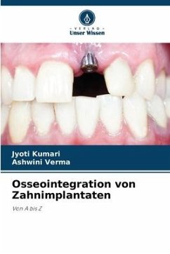 Osseointegration von Zahnimplantaten - Kumari, Jyoti;Verma, Ashwini