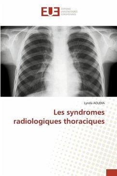 Les syndromes radiologiques thoraciques - Aoudia, Lynda