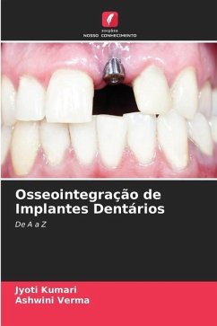 Osseointegração de Implantes Dentários - Kumari, Jyoti;Verma, Ashwini